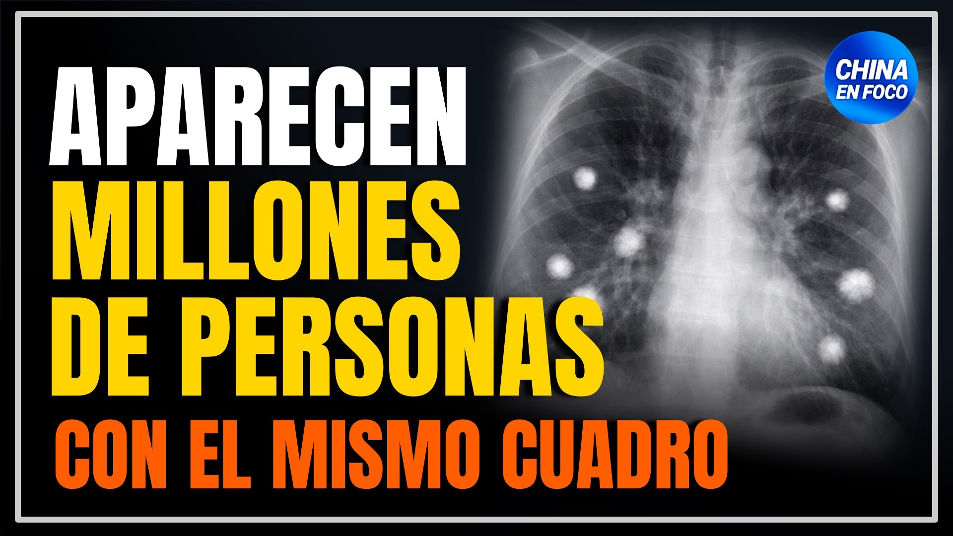 Imagen de Aparecen 150 millones de personas con el mismo cuadro médico en China