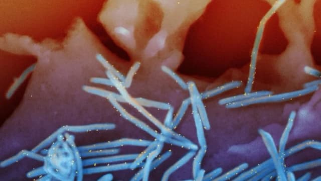 Asesores de los CDC recomiendan ampliar las vacunas contra el VSR a un grupo de menor edad
