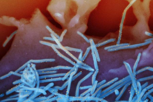 Una micrografía electrónica en color muestra viriones del virus respiratorio sincitial humano (VRS) desprendidos de células epiteliales pulmonares humanas. (NIAID a través de The Epoch Times).