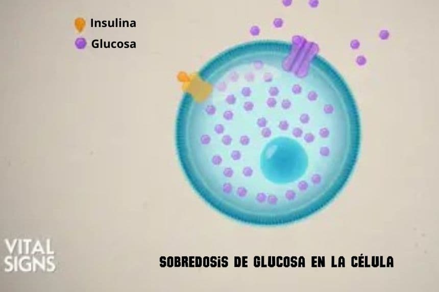 La diabetes tipo 2 está causada por la sobrecarga de glucosa en las células, no por una disfunción celular, según el Dr. Jason Fung en «Reverse Type 2 Diabetes» (Reversión de la diabetes tipo 2) en «Vital Signs».