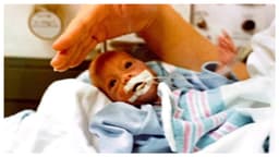 15 milagros y una oración: Nació viva a las 26 semanas tras 6 intentos de aborto de su mamá