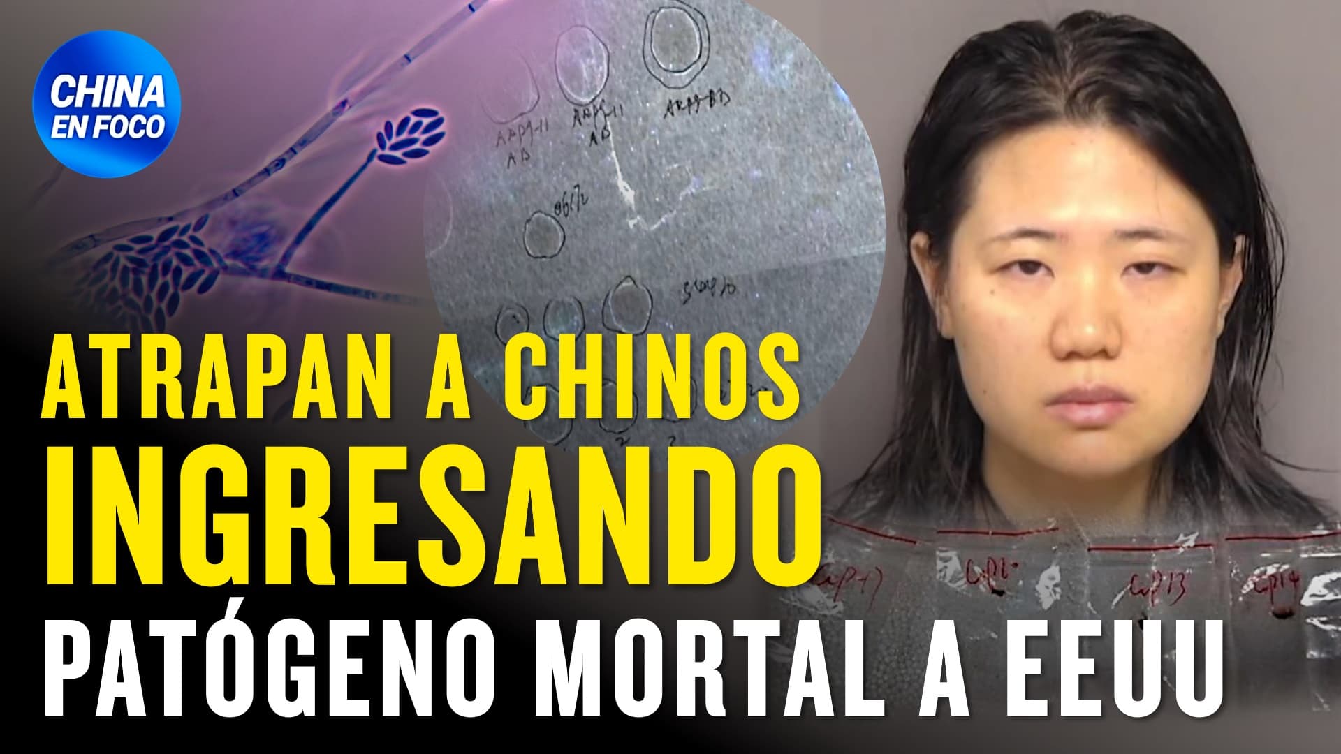 Imagen de Atrapan a dos chinos intentando entrar patógeno mortal a Estados Unidos