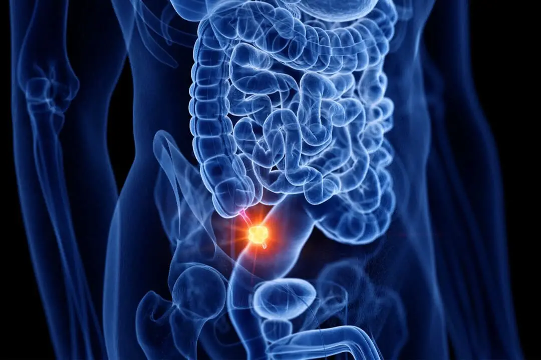 Imagen de Salud