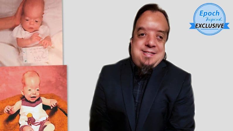 (Cortesía de Jacob Phillips) 