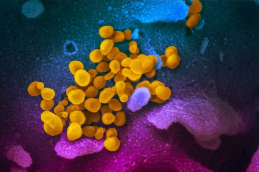 Esta imagen de microscopio electrónico de barrido, publicada el 13 de febrero de 2020, muestra el SARS-CoV-2 (amarillo), también conocido como virus CCP, el virus que causa la COVID-19, aislado de un paciente en EE. UU., emergiendo de la superficie de células (azul/rosa) cultivadas en el laboratorio. Cortesía de NIAID-RML