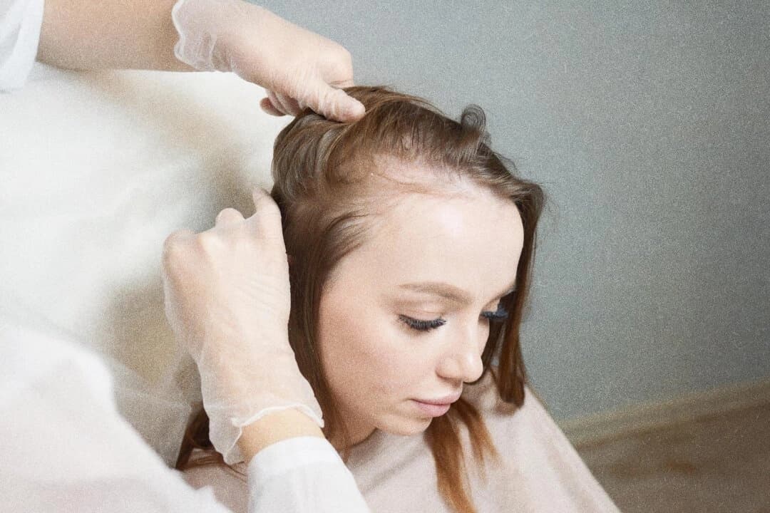 Lo que su cabello podría revelar sobre su salud