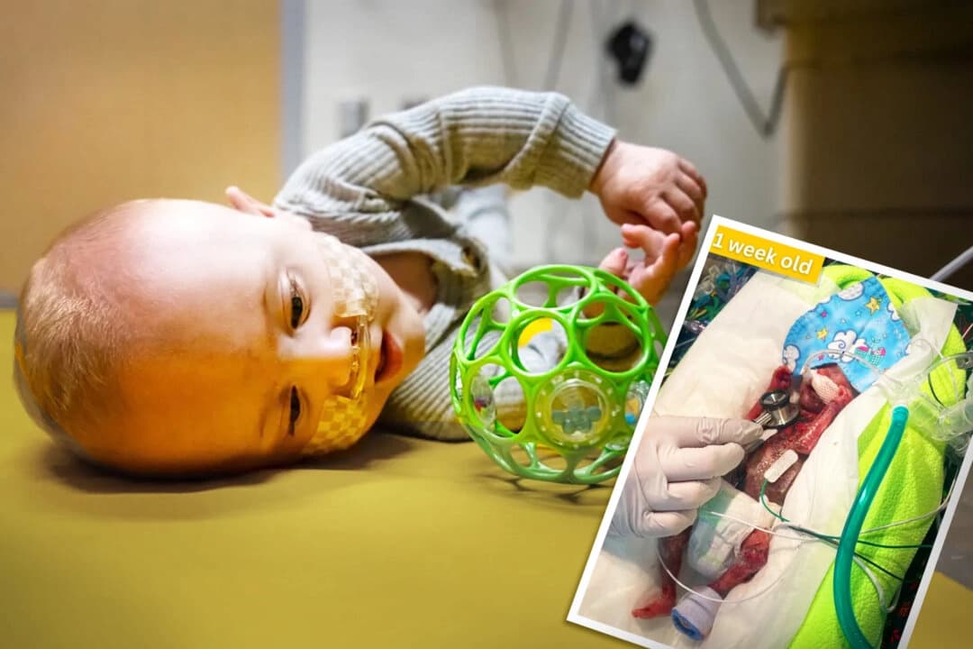 Nash Keens ya es un bebé de un año de edad. (Recuadro) El bebé Nash poco después de nacer en julio de 2024, a las 21 semanas de gestación. (Cortesía de University of Iowa Health Care)
