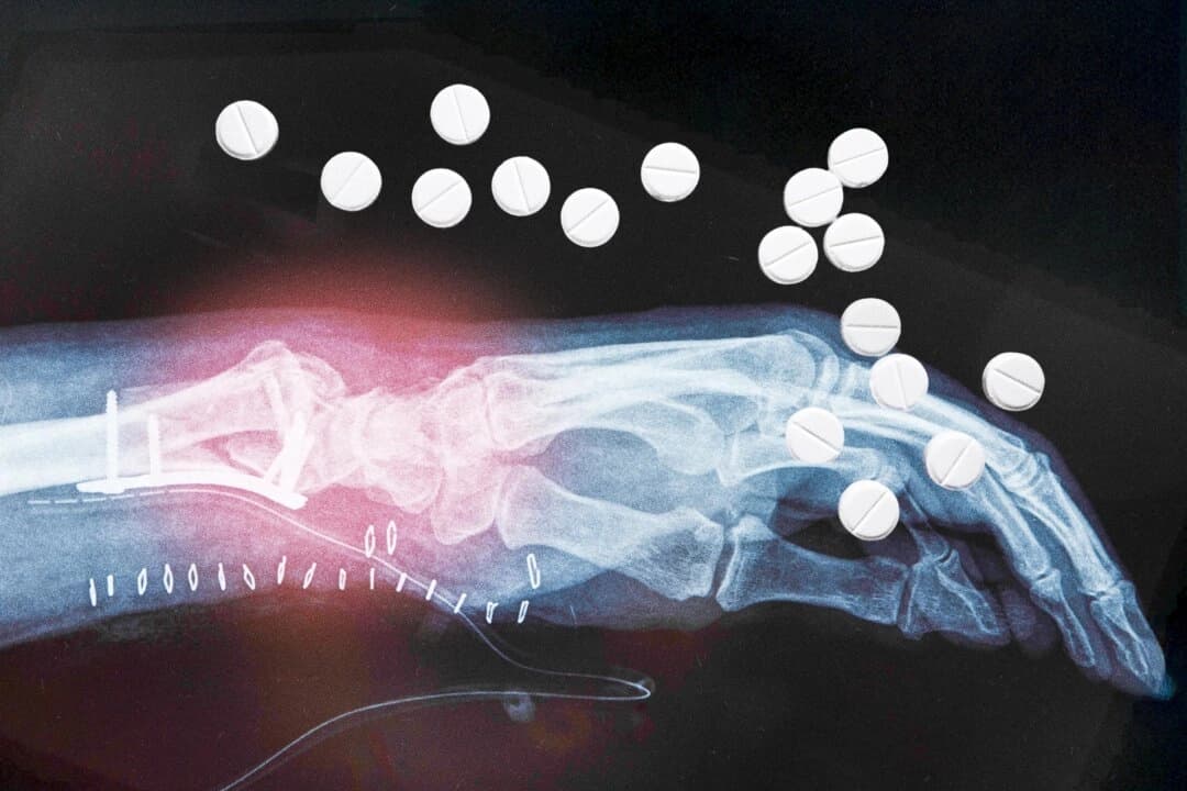 El riesgo de fractura aumenta inesperadamente con la terapia de reemplazo hormonal