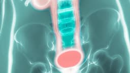 ¿Podría la actividad de la médula espinal causar incontinencia? Aqui los tratamientos
