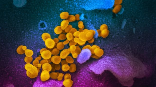 El virus COVID-19 (en amarillo) emerge de las células. (NIAID)
