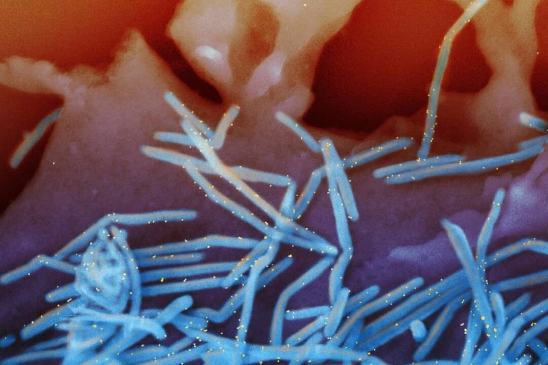 Una micrografía electrónica de barrido coloreada muestra viriones del virus respiratorio sincitial humano (VRS) desprendidos de células epiteliales pulmonares humanas. (NIAID a través de The Epoch Times)