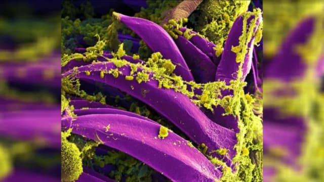 Imagen de la bacteria de la peste Yersinia pestis en una foto de archivo. (Instituto Nacional de Alergias y Enfermedades Infecciosas de EE. UU.)
