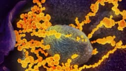 Aerosol nasal podría reducir el riesgo de infección por COVID-19 dice estudio