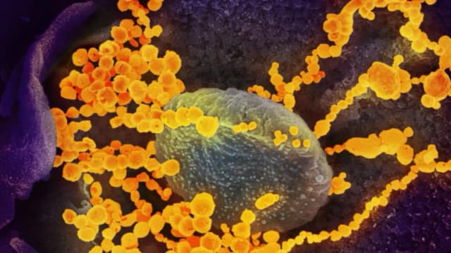 Una imagen de microscopio electrónico muestra el SARS-CoV-2 (objetos redondos de oro), causante de COVID-19, emergiendo de células cultivadas. (NIAID vía The Epoch Times9
