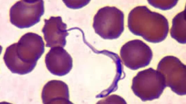 Una imagen de microscopio electrónico muestra un parásito Trypanosoma cruzi, que puede transmitirse a través de vinchucas. (CDC)
