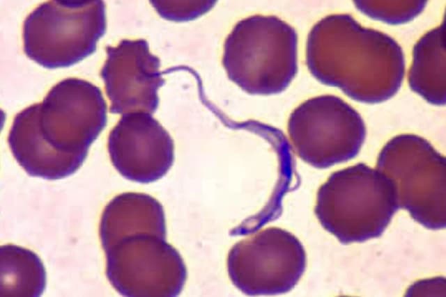 Chagas: 4 cosas a saber sobre esta enfermedad potencialmente mortal causada por "insectos besucones"