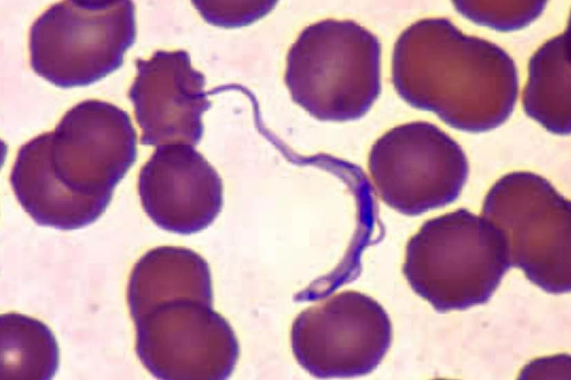 Una imagen de microscopio electrónico muestra un parásito Trypanosoma cruzi, que puede transmitirse a través de vinchucas. (CDC)

