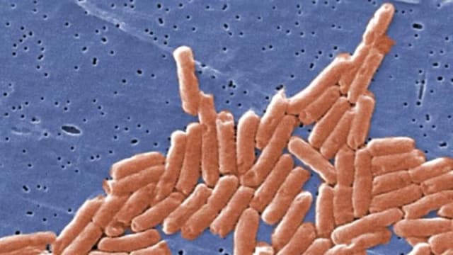 Imagen de microscopía electrónica de barrido coloreada digitalmente de un grupo de bacilos gramnegativos, o bacterias con forma de bastón, de Salmonella sp. (Janice Haney Carr/CDC)