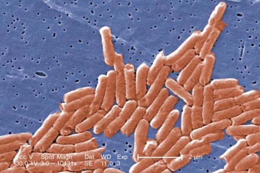 Imagen de microscopía electrónica de barrido coloreada digitalmente de un grupo de bacilos gramnegativos, o bacterias con forma de bastón, de Salmonella sp. (Janice Haney Carr/CDC)