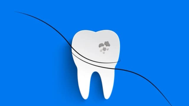 La proteína capilar podría acabar con la necesidad de empastes dentales