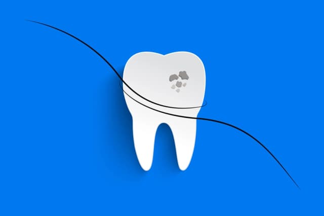 La proteína capilar podría acabar con la necesidad de empastes dentales
