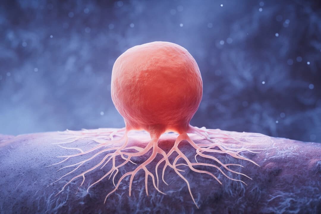 Célula cancerosa biológica y enfermedad, representación 3D. (Ilustración 3D)
