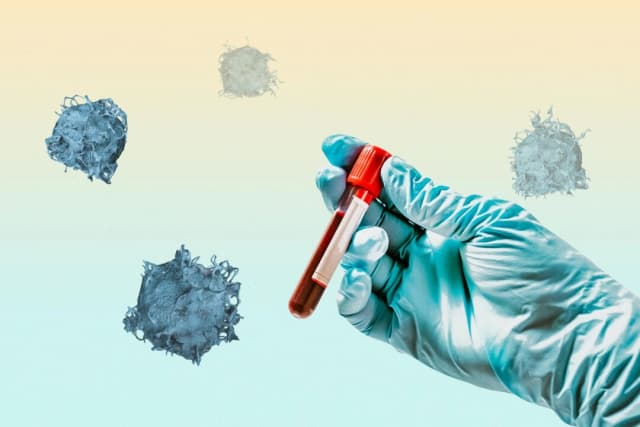 Detección del cáncer de próstata: Esto es lo que necesita saber para tomar una decisión informada