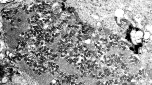 Esta imagen sin fecha tomada con un microscopio electrónico y proporcionada por los Centros para el Control y la Prevención de Enfermedades muestra viriones de la rabia, oscuros y con forma de bala, dentro de una muestra de tejido infectado. (F. A. Murphy/CDC vía AP, archivo)
