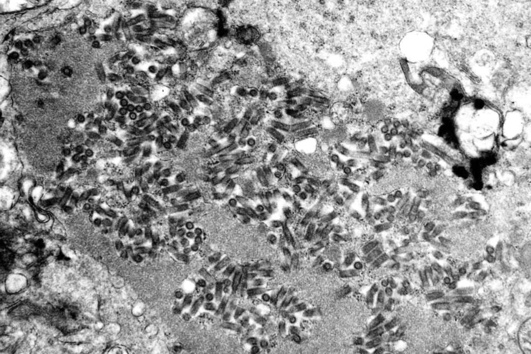 Esta imagen sin fecha tomada con un microscopio electrónico y proporcionada por los Centros para el Control y la Prevención de Enfermedades muestra viriones de la rabia, oscuros y con forma de bala, dentro de una muestra de tejido infectado. (F. A. Murphy/CDC vía AP, archivo)
