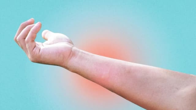 Remedios caseros sencillos para quemaduras, cortes y picaduras de insectos