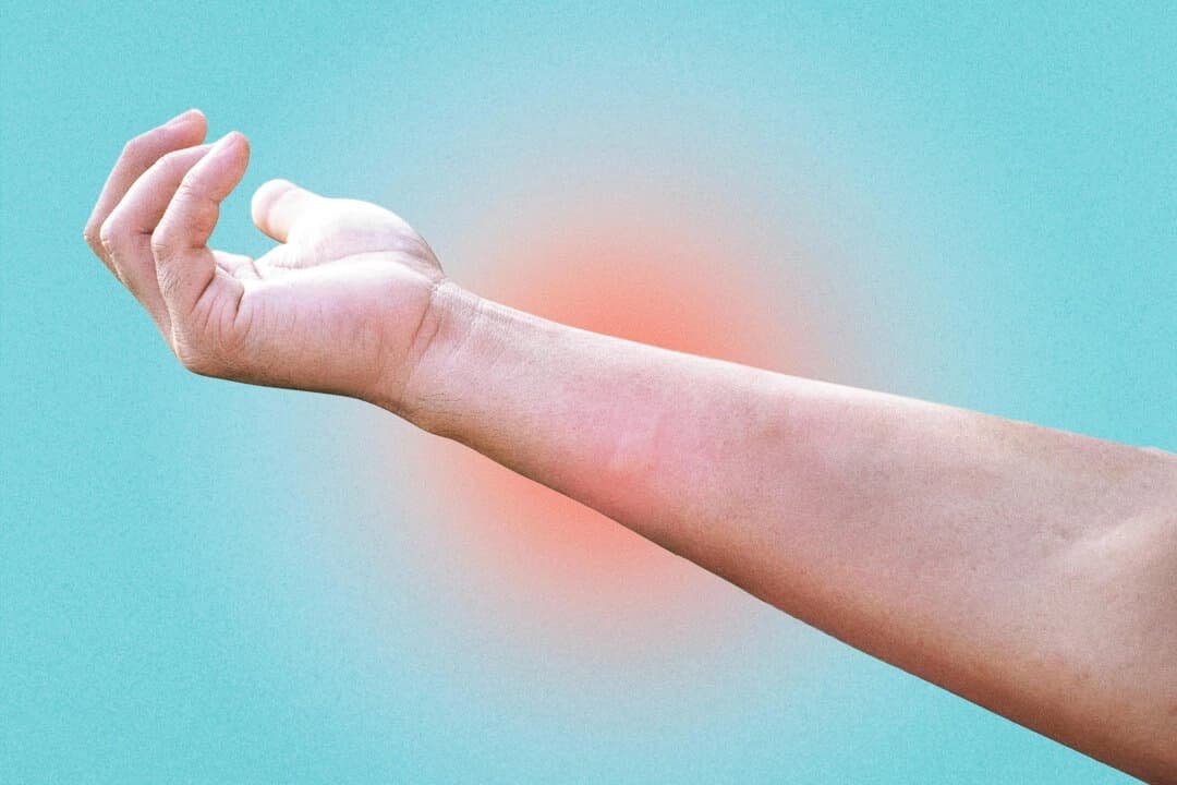 Remedios caseros sencillos para quemaduras, cortes y picaduras de insectos