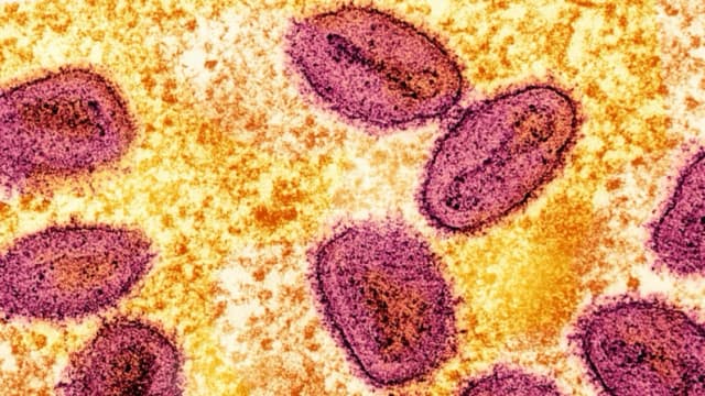 Una micrografía electrónica de transmisión coloreada sin fecha de partículas del virus mpox (rosa) encontradas dentro de una célula infectada (amarilla), cultivadas en el laboratorio, capturadas en el Centro de Investigación Integrada del Instituto Nacional de Alergias y Enfermedades Infecciosas en Fort Detrick, Maryland.   (NIAID/Folleto a través de Reuters)
