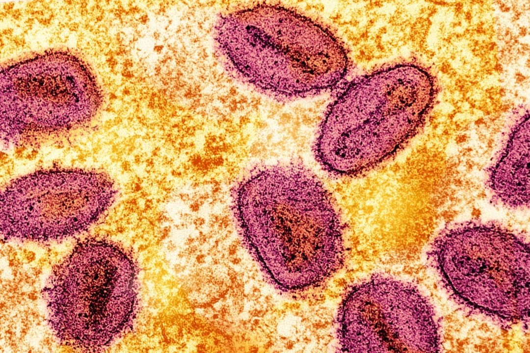 Una micrografía electrónica de transmisión coloreada sin fecha de partículas del virus mpox (rosa) encontradas dentro de una célula infectada (amarilla), cultivadas en el laboratorio, capturadas en el Centro de Investigación Integrada del Instituto Nacional de Alergias y Enfermedades Infecciosas en Fort Detrick, Maryland.   (NIAID/Folleto a través de Reuters)
