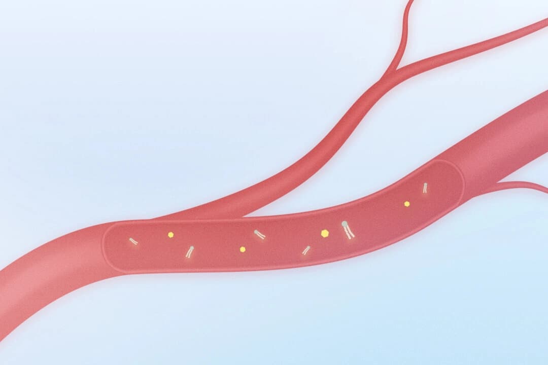 Si siempre estás cansado, tu sangre y tu dieta podrían ser las culpables