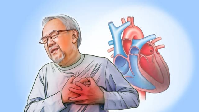 Enfermedad del corazón: Cuando el dolor de pecho se vuelve serio, tratamiento y enfoques naturales