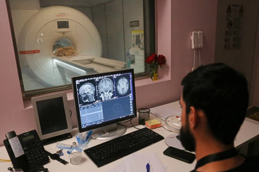 Un médico examina resonancias magnéticas (foto de archivo, Mohammed Sawaf/AFP vía Getty Images)