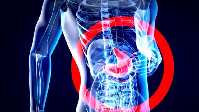 Nuevos avances en la enfermedad de Crohn permiten aplicar terapias avanzadas