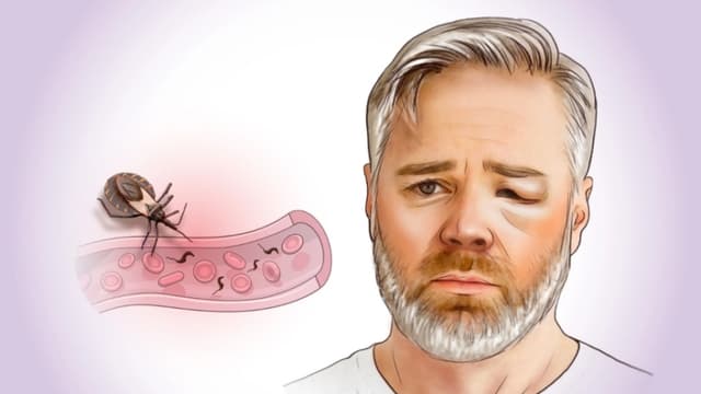 Enfermedad de Chagas: Infección oculta que se convierte en enfermedad crónica–Cómo prevenirla