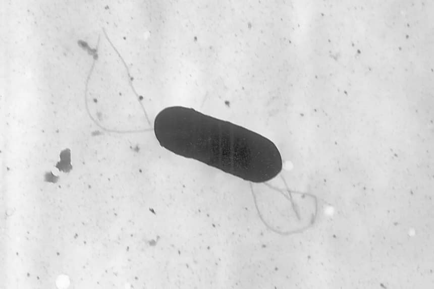 Esta imagen de microscopio electrónico facilitada por los Centros para el Control y la Prevención de Enfermedades muestra una bacteria Listeria monocytogenes, responsable de la listeriosis, una enfermedad transmitida en los alimentos. (Elizabeth White/CDC vía AP)
