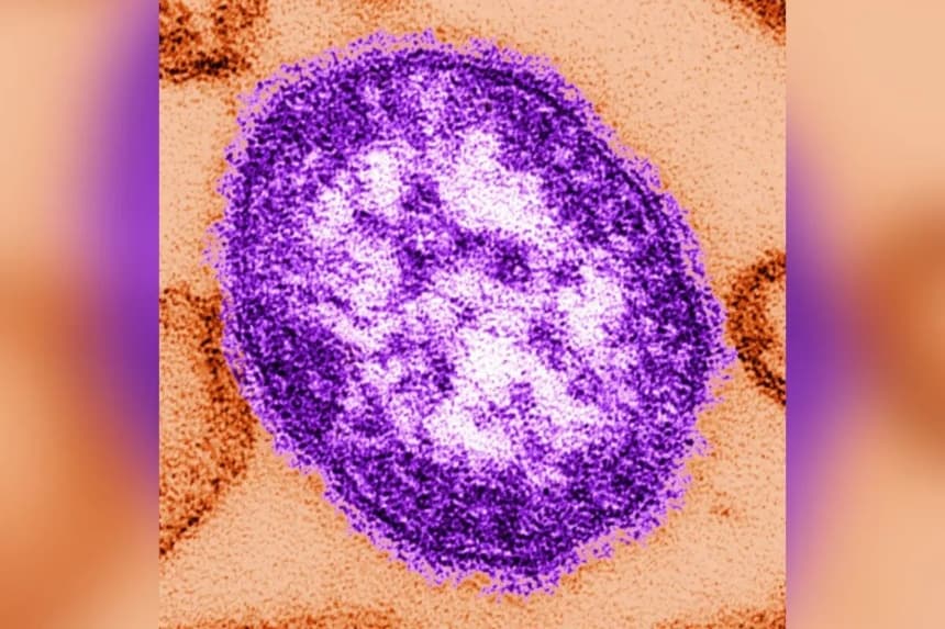Esta imagen sin fecha, facilitada por los Centros para el Control y la Prevención de Enfermedades, muestra una imagen de microscopio electrónico de una partícula del virus del sarampión, el 4 de febrero de 2015. (The Canadian Press/AP-Cynthia Goldsmith/Centros para el Control y la Prevención de Enfermedades a través de AP)