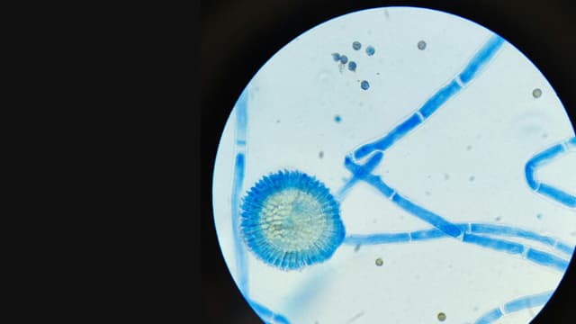 Los CDC alertan sobre más de 7700 casos de hongos multirresistentes en 30 estados