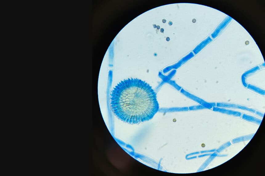 Imagen Ilustrativa: (Malik Lafi/Pexels).