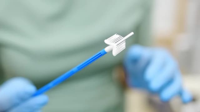 Actualizan directrices para la detección del cáncer de cuello uterino