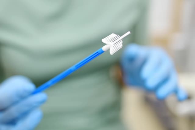 Actualizan directrices para la detección del cáncer de cuello uterino