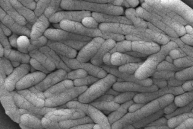 Un gran grupo de bacterias gramnegativas Salmonella typhimurium que se habían aislado de un cultivo puro en 2009. (Janice Haney Carr/CDC vía AP)