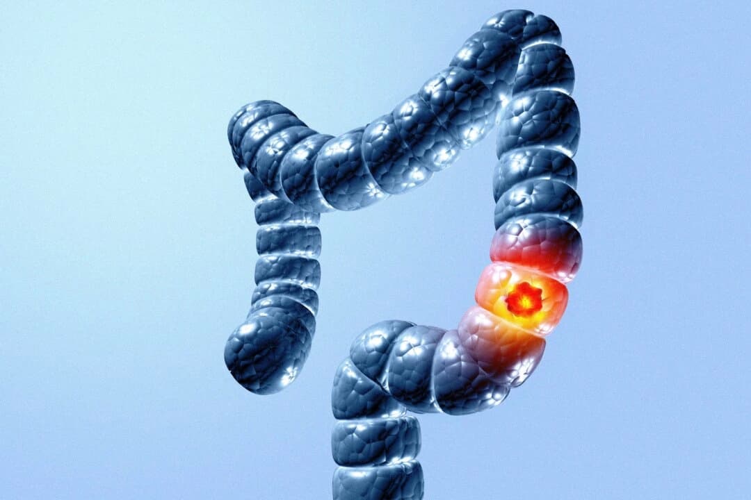 (crystal light/Shutterstock)