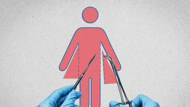 Fallo histórico que otorgó indemnización de USD 2 millones por cirugía trans marca un punto de inflexión