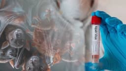 El virus Nipah y el nuevo orden de salud pública: Opinión