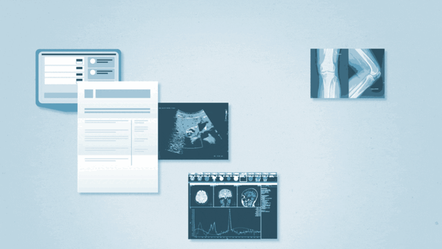 Por qué sus registros médicos pueden provocar errores y qué puede hacer al respecto