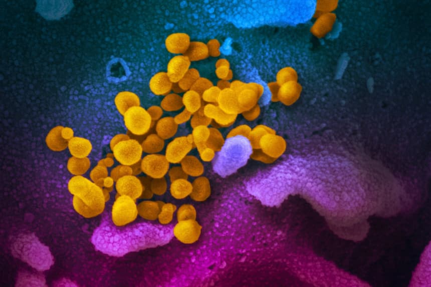 El virus COVID-19 se observa en color amarillo, emergiendo de las células. (NIAID)